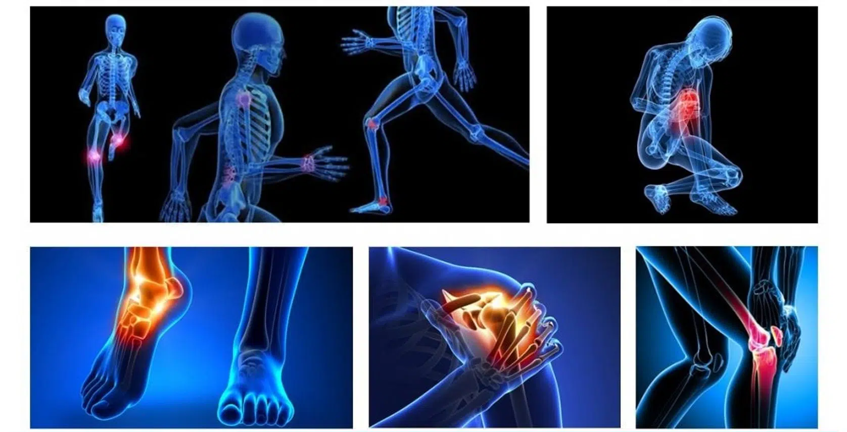 Sports Injuries Physiotherapy